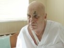 Избитый в Первоуральске депутат готовится к выписке из больницы