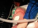 В США мужчина вышел из комы за час до запланированного отключения аппаратов обеспечения жизни