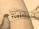 В Первоуральске ежегодно регистрируются случаи заболевания туберкулезом детей и подростков