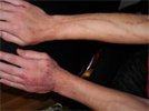 В США бьют тревогу: там появился "людоедский" наркотик из России - "крокодил"
