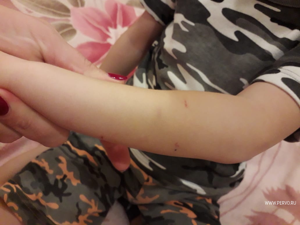 В конфликте двух воспитанников детского сада разбирается полиция