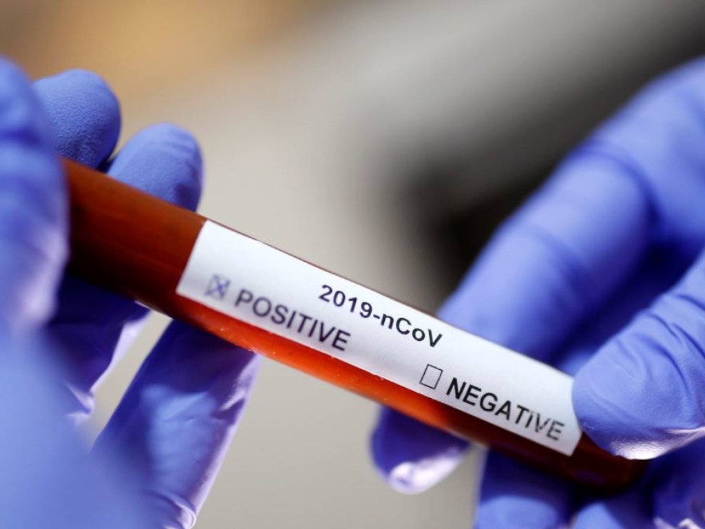 В Екатероинбурге медики подтвердили первый случай заражения коронавирусом