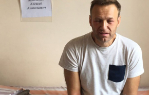 Немецкие врачи заявили, что состояние Навального продолжает улучшаться