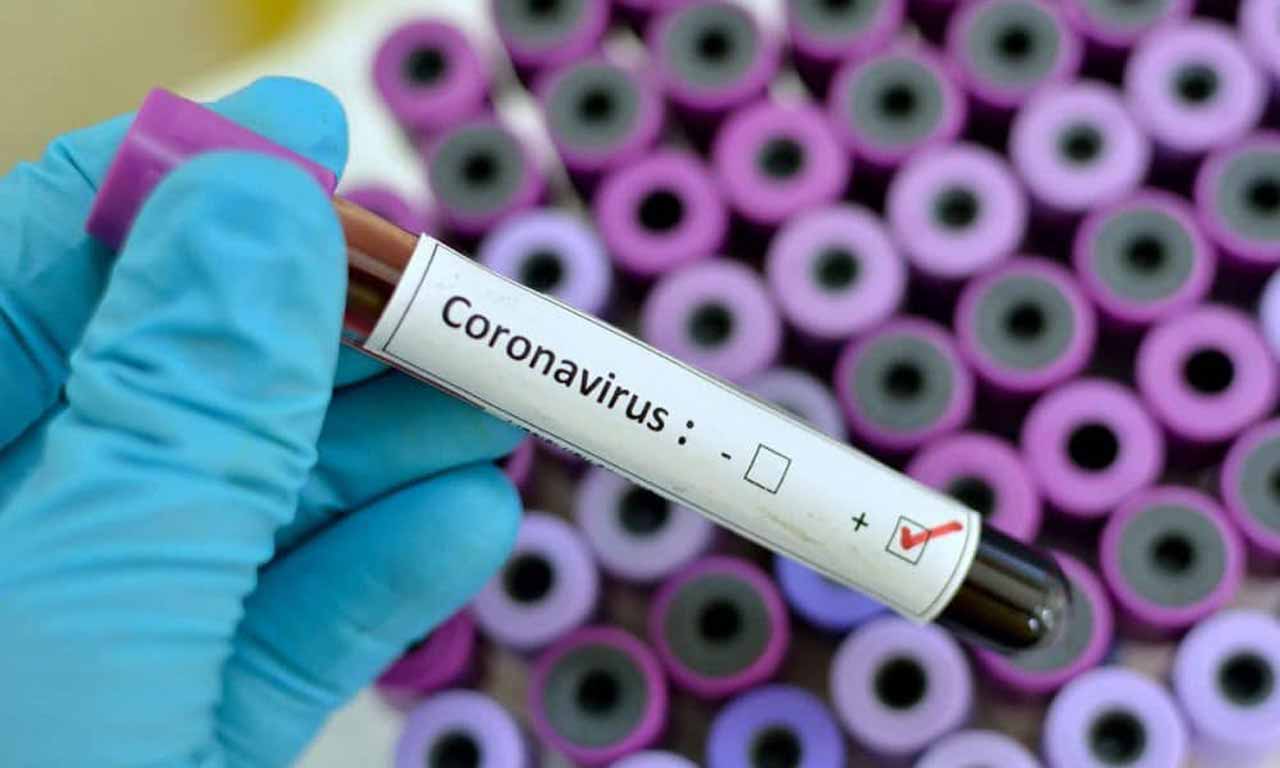 В Первоуральске девять новых случаев COVID-19