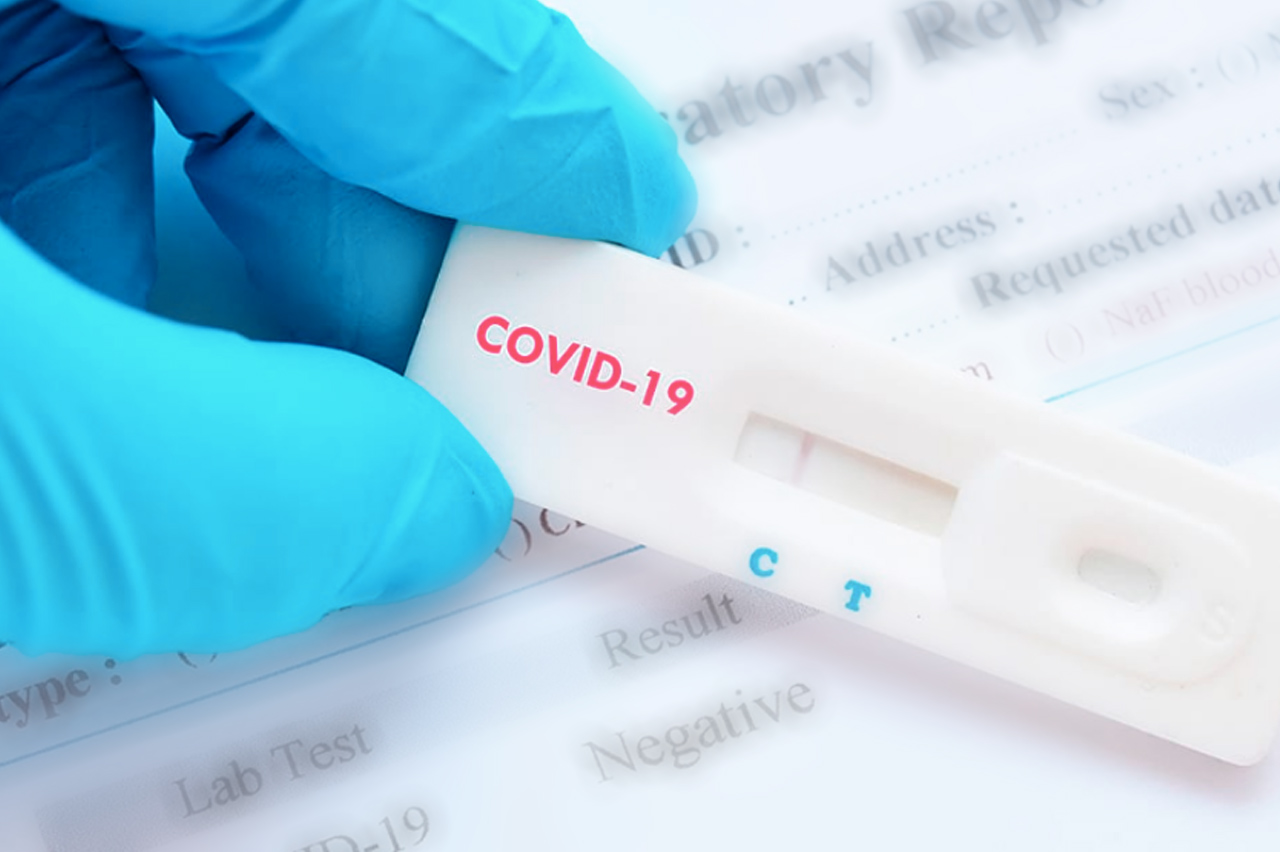 Кому положены бесплатные тесты на антитела к COVID-19
