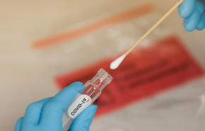 В Роспотребнадзоре разработали новый тест на коронавирус