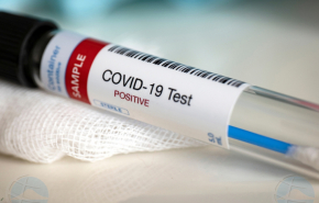 COVID может спровоцировать патологии, которые не поддаются лечению