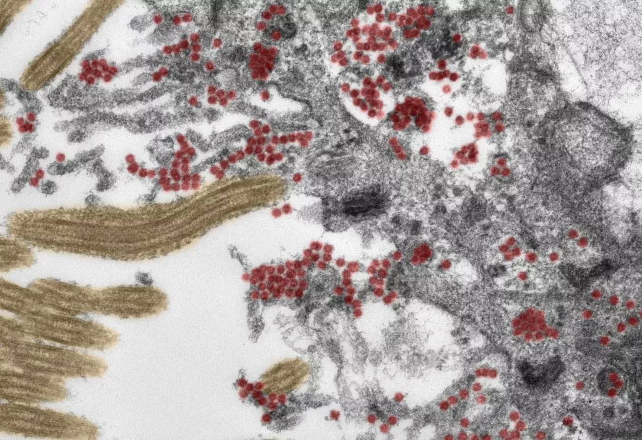 Создан препарат Oligo1, восстанавливающий пораженные коронавирусом клетки