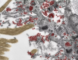 Создан препарат Oligo1, восстанавливающий пораженные коронавирусом клетки
