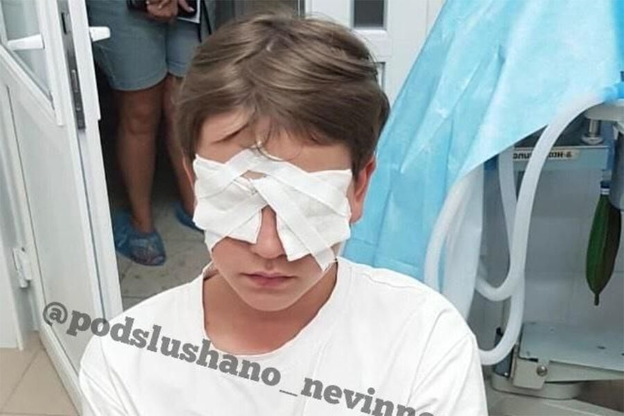 В Невинномысске мальчик был избит сверстниками в лагере до слепоты